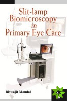 Slit-lamp Biomicroscopy in Primary Eye Care