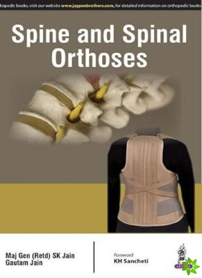 Spine and Spinal Orthosis
