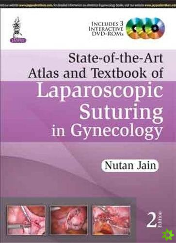 State-of-the-Art Atlas and Textbook of Laparoscopic Suturing in Gynecology