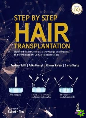 Step by Step Hair Transplantation