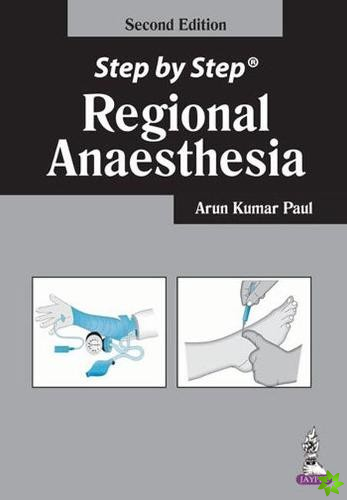 Step by Step: Regional Anaesthesia