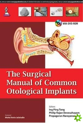 Surgical Manual of Common Otological Implants