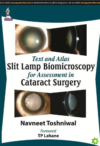 Text and Atlas: Slit Lamp Biomicroscopy for Assessment in Cataract Surgery