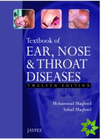Textbook of Ear, Nose and Throat Diseases