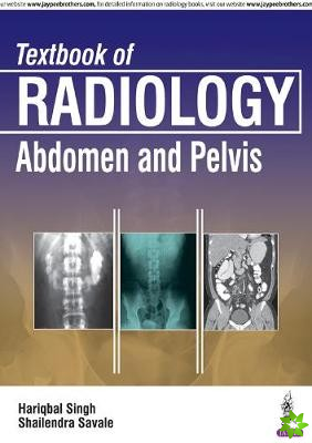Textbook of Radiology: Abdomen and Pelvis