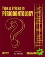 Tips and Tricks in Periodontology
