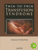 Twin-to-Twin Transfusion Syndrome