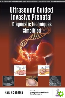 Ultrasound Guided Invasive Prenatal Diagnostic Techniques Simplified