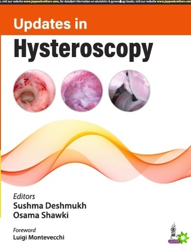 Updates in Hysteroscopy