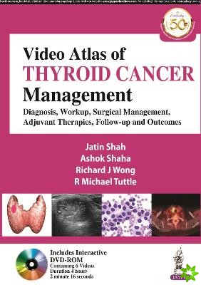 Video Atlas of Thyroid Cancer Management