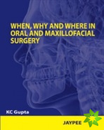 When, Why and Where in Oral and Maxillofacial Surgery