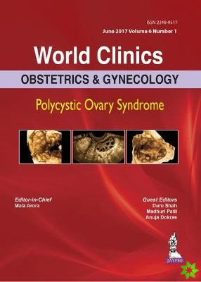World Clinics: Obstetrics & Gynecology: Polycystic Ovary Syndrome