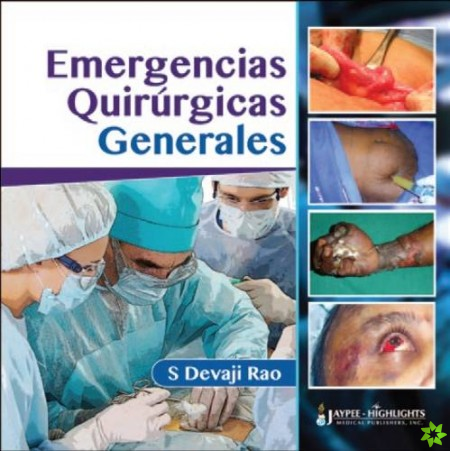 Emergencias Quirurgicas Generales