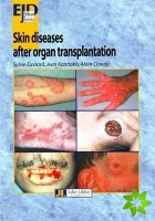 Skin Diseases After Organ Transplantation
