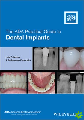ADA Practical Guide to Dental Implants