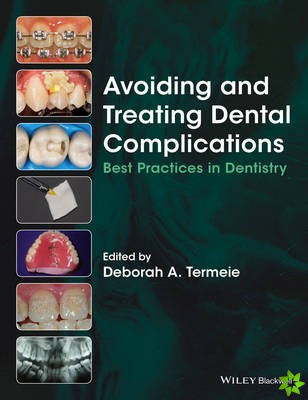 Avoiding and Treating Dental Complications
