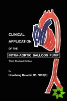 Clinical Application of Intra-Aortic Balloon Pump