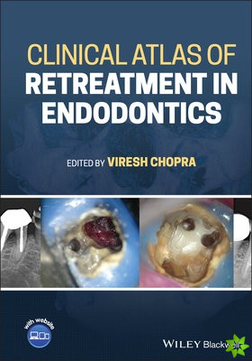 Clinical Atlas of Retreatment in Endodontics