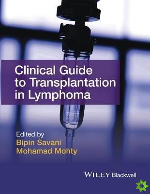 Clinical Guide to Transplantation in Lymphoma
