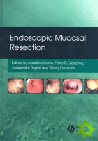 Endoscopic Mucosal Resection