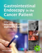 Gastrointestinal Endoscopy in the Cancer Patient