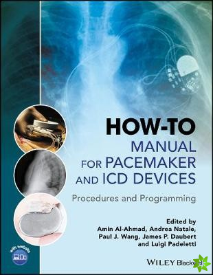 How-to Manual for Pacemaker and ICD Devices