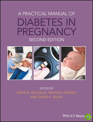 Practical Manual of Diabetes in Pregnancy