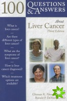100 Questions & Answers About Liver Cancer