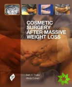 Cosmetic Surgery after Massive Weight Loss
