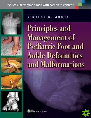 Foot and Deformities and Malformations in Children: A Principles-Based, Practical Guide to Assessment and Management