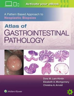 Atlas of Gastrointestinal Pathology: A Pattern Based Approach to Neoplastic Biopsies
