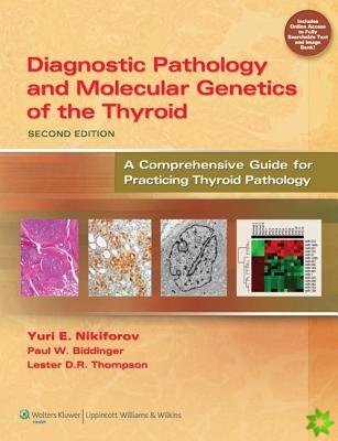 Diagnostic Pathology and Molecular Genetics of the Thyroid