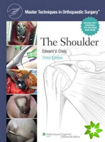 Master Techniques in Orthopaedic Surgery: Shoulder