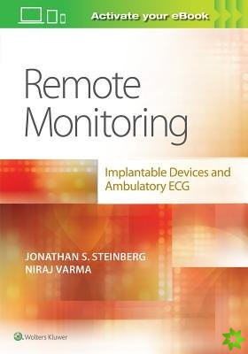 Remote Monitoring: implantable Devices and Ambulatory ECG