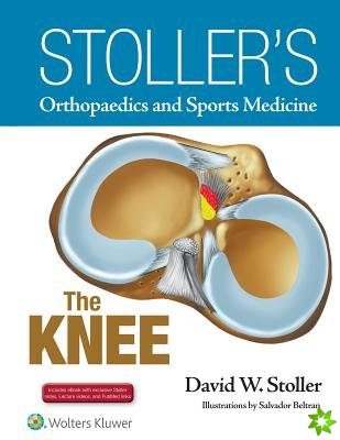 Stoller's Orthopaedics and Sports Medicine: The Knee