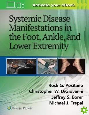 Systemic Disease Manifestations in the Foot, Ankle, and Lower Extremity