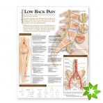 Understanding Low Back Pain Anatomical Chart