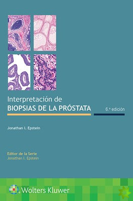 Interpretacion de biopsias de la prostata