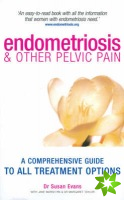 Endometriosis And Other Pelvic Pain