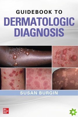Guidebook to Dermatologic Diagnosis