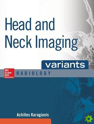 Head and Neck Imaging Variants