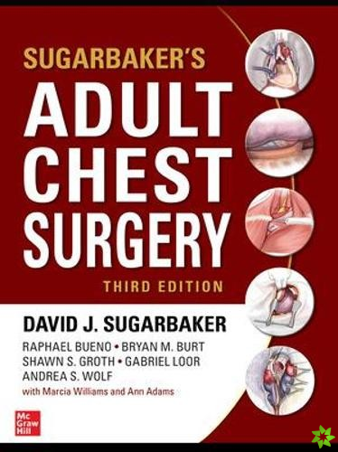 Sugarbaker's Adult Chest Surgery