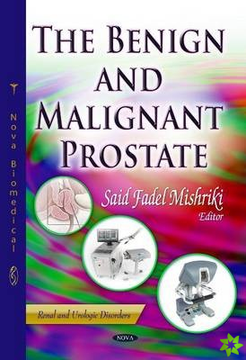 Benign & Malignant Prostate