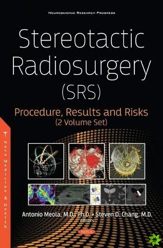 Stereotactic Radiosurgery (SRS)
