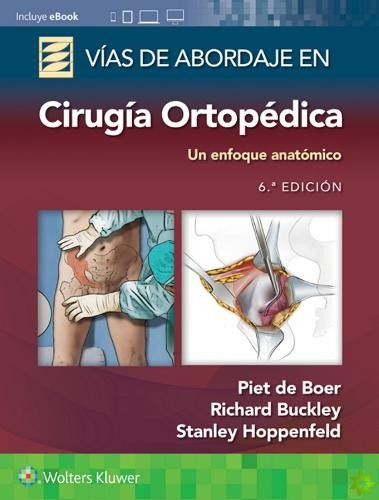 Vias de abordaje de cirugia ortopedica. Un enfoque anatomico