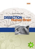 Dissection of the Human Brain