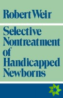 Selective Nontreatment of Handicapped Newborns