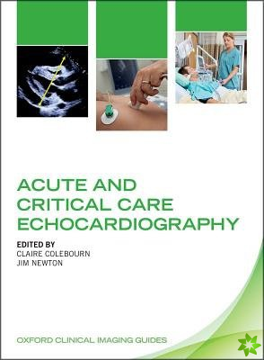 Acute and Critical Care Echocardiography