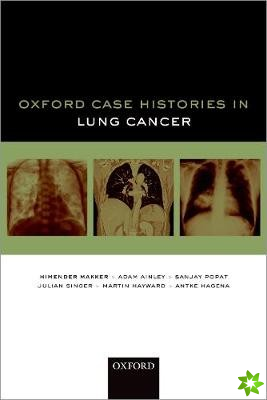 Oxford Case Histories in Lung Cancer