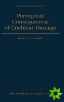Perceptual Consequences of Cochlear Damage